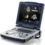 01_GE_V2_portable_ultrasound_machine