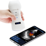 portable-Ultrasound-Scanner